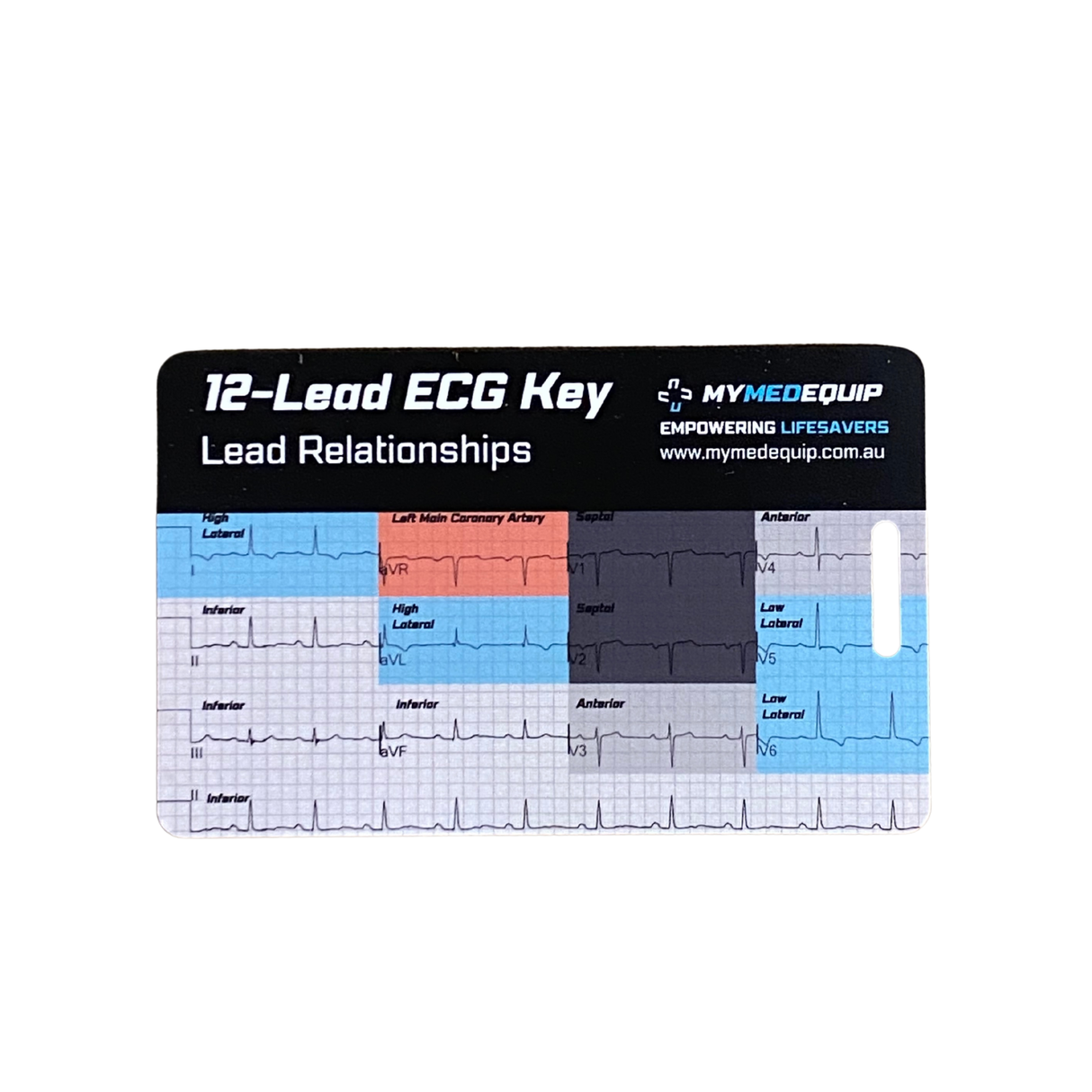 ECG quick reference card showing rhythm interpretations and STEMI heart regions