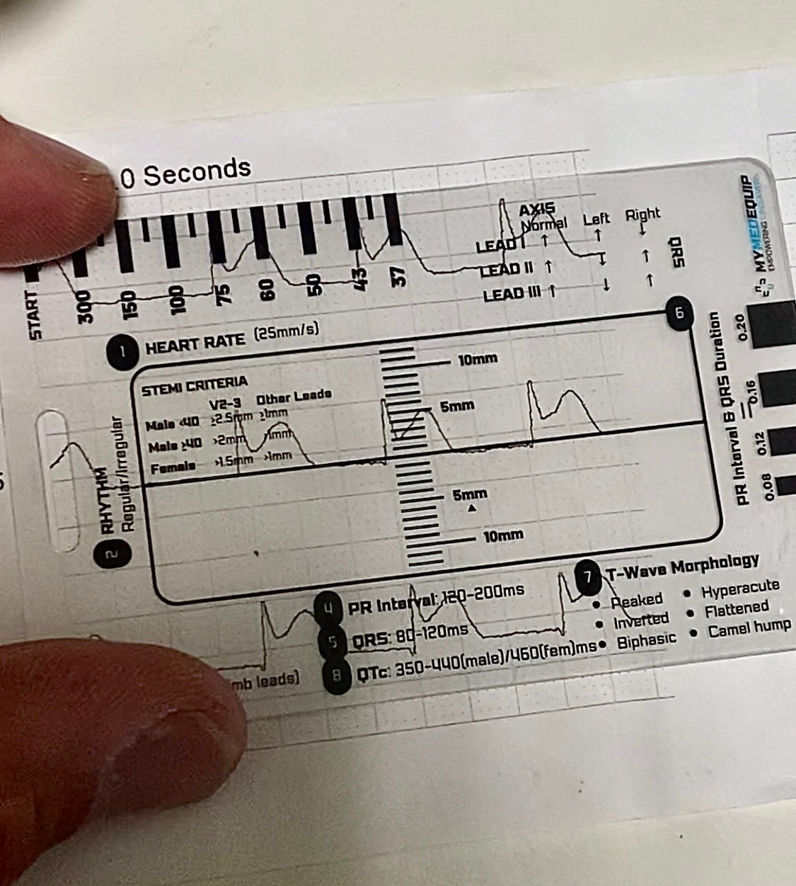 An ECG reference card and ruler being used to measure intervals and ST Elevation on an ECG printout.