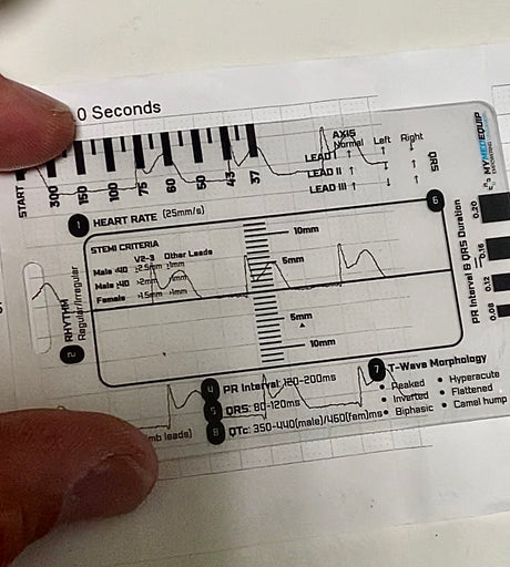 ECG Interpretation Card Overlaid on ECG