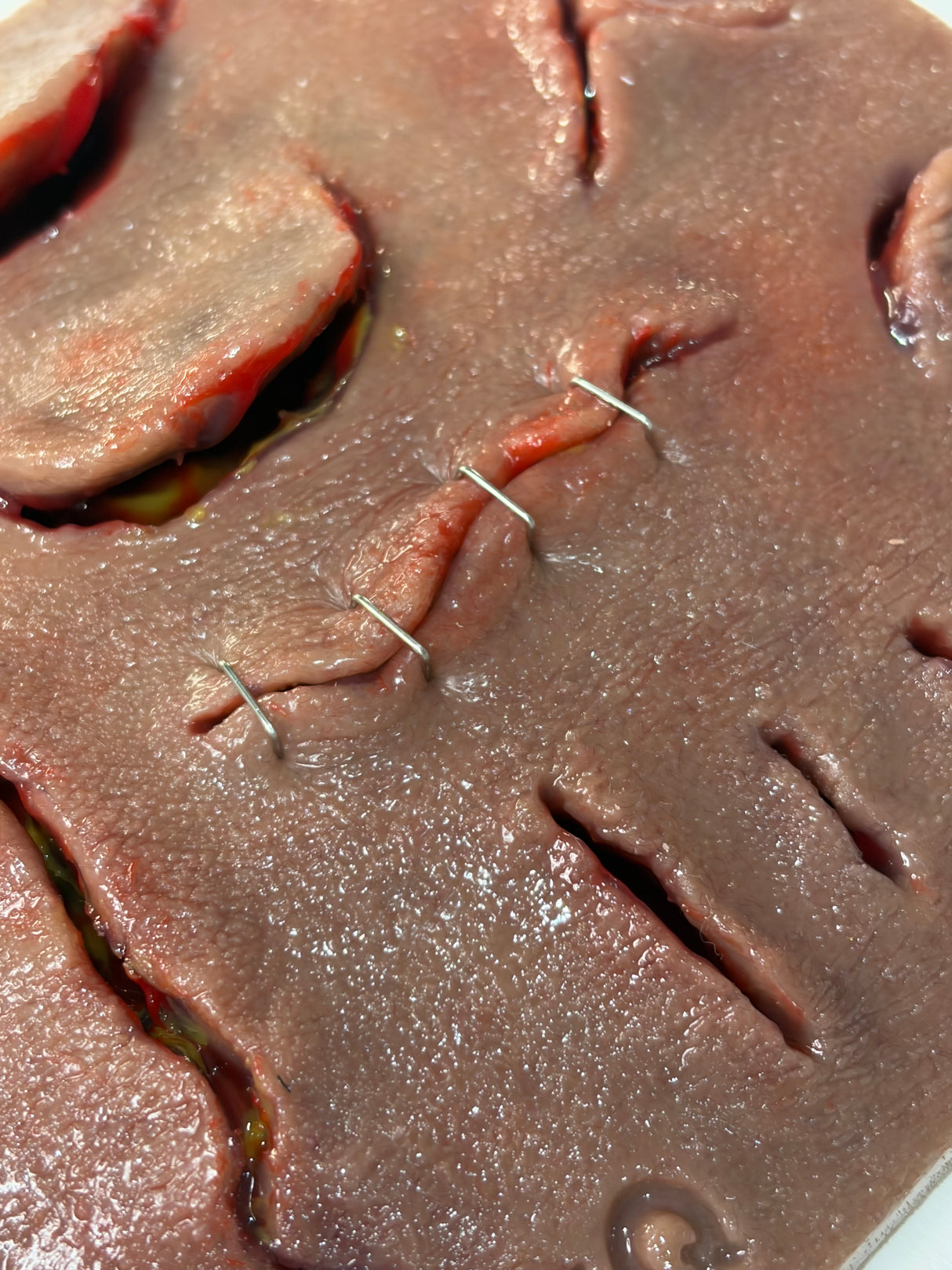 Suture-IQ