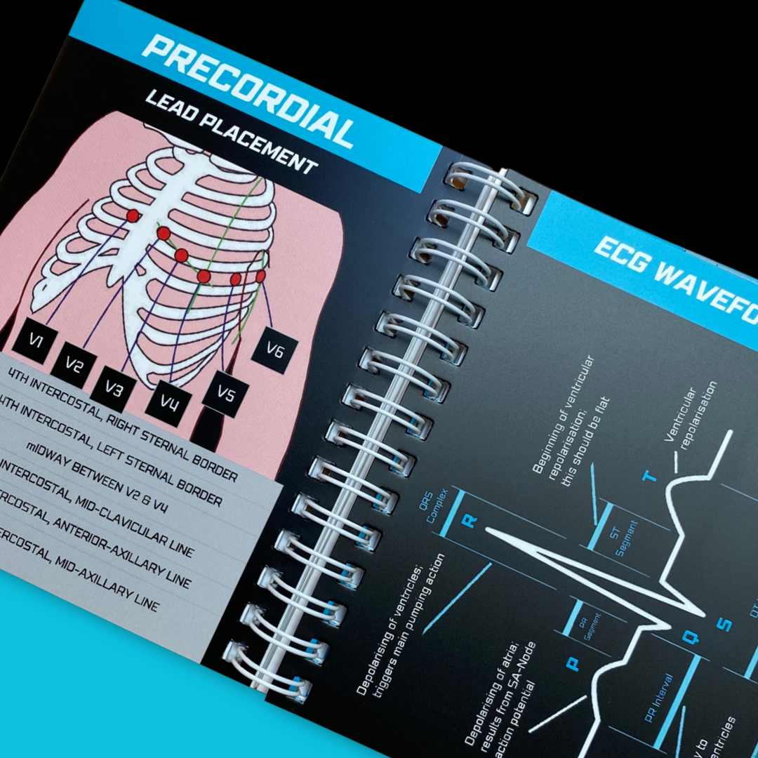 ECG Waveform Key & Lead Placement