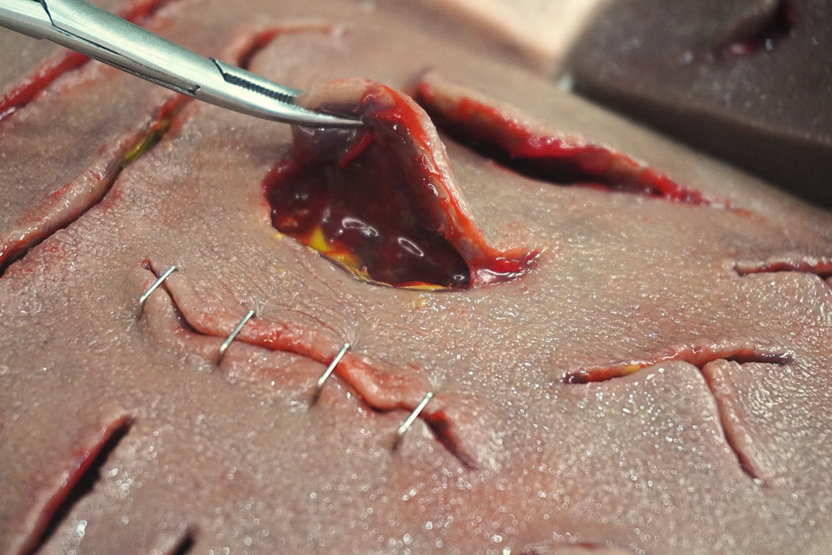 Suture-IQ