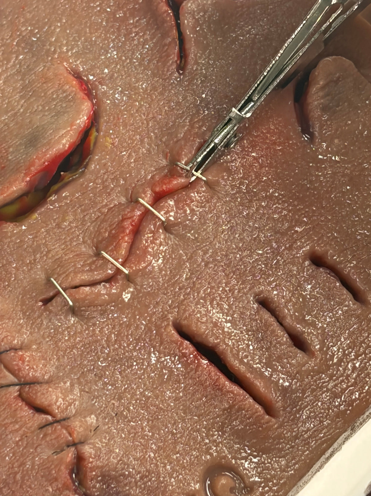 Suture-IQ