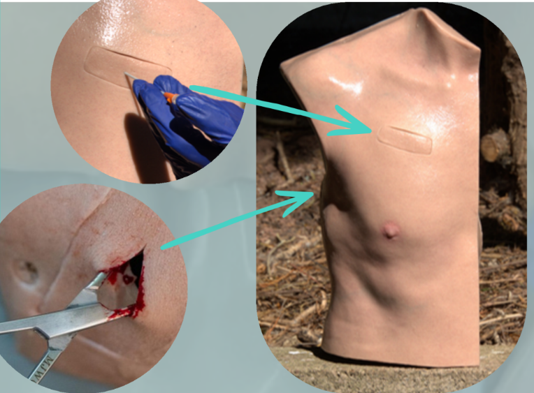 Thora-IQ Needle Decompression & Chest Drain Trainer — High-Fidelity Chest Trauma Simulator